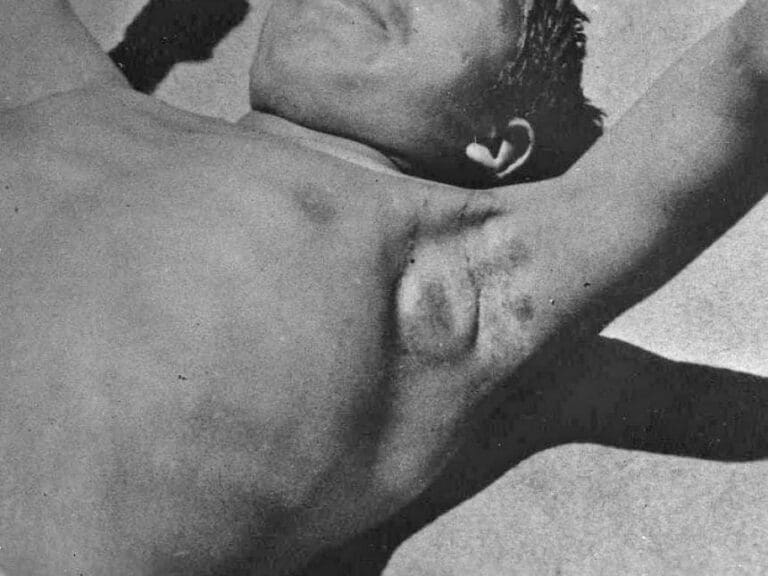 Afrika: Pest fordert 27 Menschenleben — Bild: Otis Historical Archives of "National Museum of Health & Medicine" / Wikimedia(CC-BY-2.0)