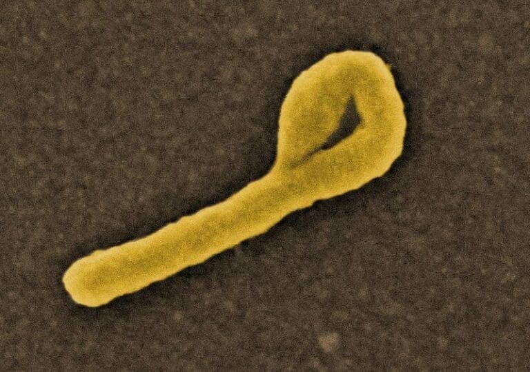 Ebola-Seuche breitet sich im Kongo aus — Bild: NIAID / Wikimedia (CC-BY-2.0)