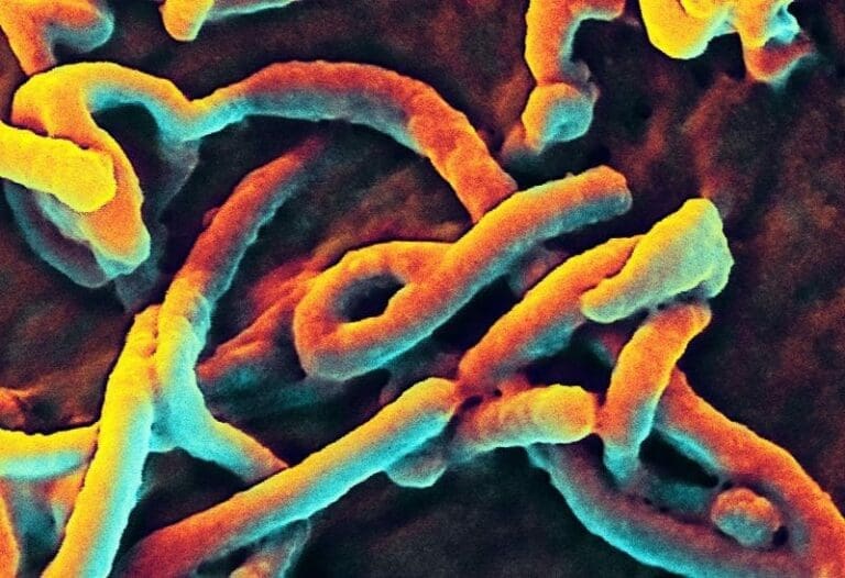 Bereits 2.000 Ebola-Tote  im Kongo zu beklagen — Bild: NIAID / Wikimedia (CC-BY-2.0)