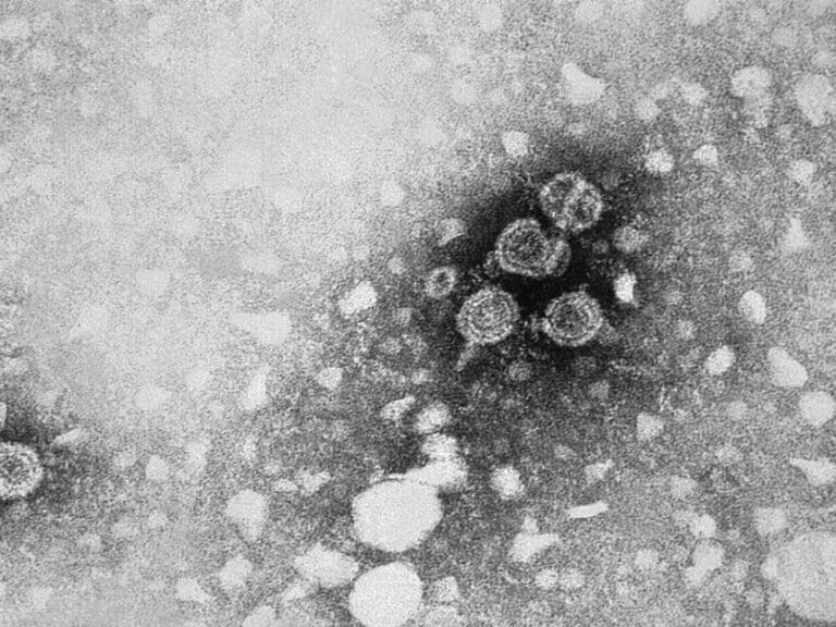 31 Prozent der Hepatitis-B-Fälle treten bei Asylwerbern auf — Bild: Public Health Image Library / Wikimedia (PD)