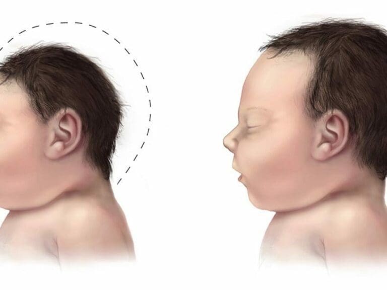 WHO prüft Zika-Gefahr bei Olympia — Bild: Centers for Disease Control and Prevention / Wikimedia (PD)