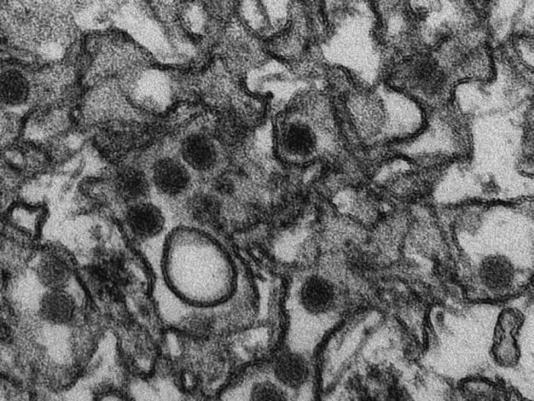 Meldepflicht für Zika-Virus — Bild: CDC/ Cynthia Goldsmith / Wikimedia (PD)